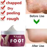 KURAIY Advance Chapped Hand And Foot Cream Crack Peeling Repair Anti Dry Skin Remove Dead Skin Foot Moisturizing (50gm) (For Women and men) Pack of 1