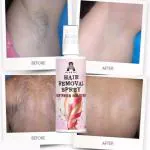 ALOETIC Hair Removal Spray , hair removal cream , bal ko nikalne ka cream , nicheke bal hatane ka cream , | For Bikini, Legs, Arms & UnderArm | Removes Hair in 10 Minutes with Skin Detan | Gives 3 Full Body Usage in 100 ml