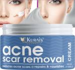 KURAIY ACNE SCAR CREAM 50GM