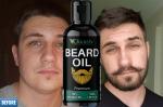 KURAIY Growth Beard Oil Grow Beard Thicker & More Full Thicken Hair Beard Oil For Men Beard Grooming Treatment Beard Care