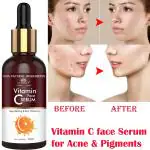 Intimify Vitamin C serum for Age Spots, Remove Dark Spot & Pigmentation