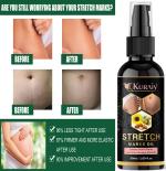Kuraiy Natural present Repair Stretch Marks Removal Cream - Natural Heal Pregnancy Breast.