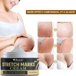 KURAIY Pure new Pregnancy Scars Remove Stretch Marks Cream Treatment Maternity Repair Anti-Aging Anti-Wrinkles Firming Stretch Mark Body Creams