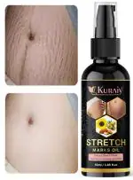 Kuraiy present Repair Stretch Marks Removal Cream - Natural Heal Pregnancy Breast, Hip, Legs, Mark Cream 50 gm pack of 1 Stretch Marks And Scars Creams & Oils