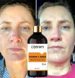 CONWY Mild 5% Vitamin C Face Serum (32 ML)