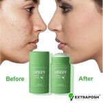 Extraposh Green Tea Aloe Beauty Anti Acne Purifying Oil Contro Detoxifying Clat Stick Mask for Pimple Free Skin