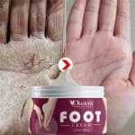 KURAIY 100% Chapped Hand And Foot Cream Crack Peeling Repair Anti Dry Skin Remove Dead Skin Foot Moisturizing (50gm) (For Women and men) Pack of 1