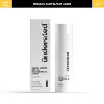 Underated Azelaic Acid 9% GDL 5% Niacinamide 4% Cream - 30ml | Averts Acne Spots and Fades Acne Scars