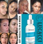 LUCACCI Face Serum 2% salicylic acid, glycolic aicd,hyaluronic acid ,tea tree oil , camellia japonice 30 ml