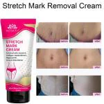 Intimify Stretch Mark Cream to Minimize Stretch Marks & Even Out Skin Tone