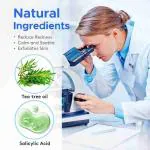 MOTGIK Face Acne Pimple Patch - Pack of 72 | Pimple Healing & Spot Clearing Patch | Absorbing Cover |Invisible, Blemish Spot, Hydrocolloid, Skin Treatment Acne Cover