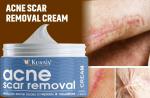 KURAIY ACNE SCAR CREAM 50GM