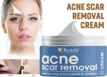 KURAIY Scar Removal Cream Gel Remove Acne Spots Treatment Stretch Marks Burn Surgical Scar Repair Cream