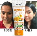 KURAIY Facial Cleanser Brush Head Design Face Massage Washing Deep Cleansing