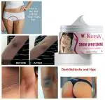 KURAIY 100% Pure Body Whitening Cream Underarm Bleaching Serum Whiten Butt Knee Brighten Inner Thigh Intimate Dark Remove Melanin