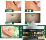 KURAIY Natural Pregnancy Repair Cream Maternity Stretch Marks Removal Acne Scars Remove Anti White Anti-Winkle Repair Firming Body Skin Care
