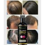 KURAIY 100% Onion oil Regrow Hair Care Biotin Hair Growth oil Triple -On Massager Hair Growth Essence for All Hair Types 50ml