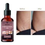 Groovy Skincare Oil for Pregnancy Stretch Marks with Argan Oil Saffron and Vitamin E Combo (Pack OF 1 40 ML