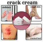 FLEX FIVE Crack Cream 20Gm Repairs Cracked Heel | Crack Heel Repair Cream For Women & Men, Moisturizes Dry Feet, Combats Feet Odour & Infections