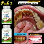 Smartdrops Natural Activated Charcoal Teeth Whitening Powder Teeth Whitening Kit Teeth Whitening Kit (Pack Of 2)