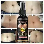 Kuraiy Best Actives Stretch Marks Removal Cream Oil for Women in During After Pregnancy No Paraben No Sulphate No Added Colors or Fragrance No Mineral Oil Cellulite Remover Massage Slimming Oil Remove