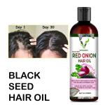 Vitracos ONION HAIR OIL with the goodness of ginger & flaxseed 100% pure & natural an ayurvedic blend for faster hair growth & complete nourishment suits all hair types Hair Oil  (100 ml)