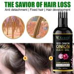 KURAIY RED Onion Oil For Hair Care And Protects Damaged Hair For Moisture Hair