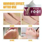 KURAIY 100% Foot Crack Cream For Dry Cracked Heels & Feet Foot Cream (50gm) Pack of 1 For Men And Women