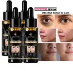 ODDEVEN Salicylic Acid 2% Betaine 3% Serum Powered with Horsetail Kemp and Witch 30ml(PACK OF 4)