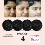 BADA HAIR _ Activated Charcoal Soap for skin whitening, Treat Oily Skin.
