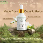 Herbalsupport Hair Serum for Hair Growth with Dandruff Control | 30 ml (pack of1 )