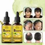 INDEZIRE Anti Hair Loss and Hair Regrowth Treatment Hair Growth Serum, 30 ml each - Pack Of 2