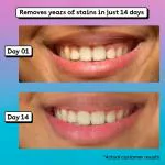 Niwadri Collection Teeth Whitening Strips| Effectively Removes Years of Teeth Stains| Enamel Safe Teeth Whitening | FDA Approved | Sensitivity & Peroxide Free | Vegan, Non Toxic | 28 Strips