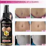 Kuraiy Natural-Oil Original Face & Body Oil, suitable for Acne Scar Removal, Pigmentation, Dark Spots & Stretch Marks