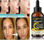 Elibliss Vitamin C Brightening Face Serum for Men and Women, 30ml (Pack of 1)