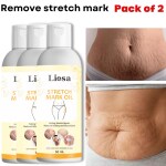 LIOSA, stretch mark oil, Premium Repair Stretch Marks Removal oil, Natural Heal Hip, Legs, Mark oil, Stretch Marks And Scars Oils, pack of 3 (50 ml)
