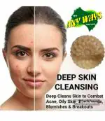 Any Ways Activated Haldi Chandan & Vitamin E Handmade Bathing Soap For For Skin Whitening, Tan Removal, Treat Oily Skin And Deep Cleansing Combo Pack Of 5 (5X100Gm) | Chemical Free Soap