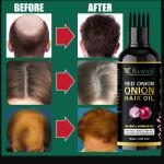 KURAIY Hair Growth And Hair Care Oil Natural Care for Hair Loss  50 ML