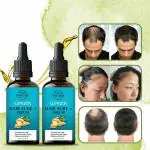 INDEZIRE Ginger Hair Oil Growth Serum Glue Essence Hair Oil, 30 gm each - Pack Of 2
