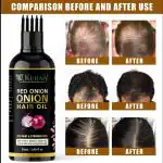 KURAIY 100% Onion and Basil Oil for Anti Hair Fall Pack of 1 Hair Oil (50 ml) & (MEN & WOMEN)