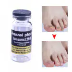 AdiExpress Fungus Nails Treatment, 5 Days Nail Growth Keratin Vitamin E, Nail Growth Repair Oil