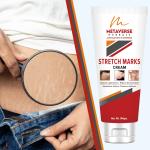 Metaverse Stretch mark lotion hydrates and soothes dry skin Under Arm Body Fat Mark