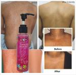 amr beauty tanning dead skin remover100ml (a6)