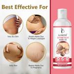 GLAMOVA Stretch Marks for Women Stretch Mark Oil for Pregnancy,pregnant ladies & new mothers, lightweight oil for stretch mark removal Skincare Oil suitable for Stretch Marks | Scar Removal | Uneven Skin Tone
