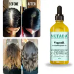 MOTABA Veganik Natural Hair Growth Oil - 100% Natural Anti-Dandruff Treatment, Nourishing Scalp & Hair Strengthening Formula, Almond, Neem, and Tea Tree Oils, Reduces Hair Fall, 180 ml