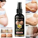 Kuraiy Natural Actives Stretch Marks Removal Cream Oil for Women in During After Pregnancy No Paraben No Sulphate No Added Colors or Fragrance No Mineral Oil Cellulite Remover Massage Slimming Oil Remove Scars 50 ml