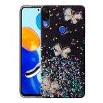 SROCK Xiaomi Mi Redmi Note 7, Note 7s, Note 7 Pro Back Case Cover for Girls | Sparkle Glitter | Stylish | Designer |Ladies Women Back Case Cover for Xiaomi Mi Redmi Note 7, Note 7s, Note 7 Pro- Black