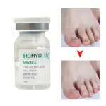 AdiExpress Fungus Nails Treatment, Nail Correction Repair, Onychomycosis Essence Liquid