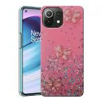 SROCK Mi 11 Lite NE 5G, Mi 11 Lite Back Case Cover for Girls | Sparkle Glitter | Stylish for Ladies Women Back Case Cover for Mi 11 Lite NE 5G, Mi 11 Lite-Pink