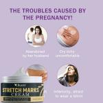 KURAIY New Remove Pregnancy Scars Acne Cream Stretch Mark Treatment Maternity Repair Anti-Aging Anti-Winkle Firming Body Cream